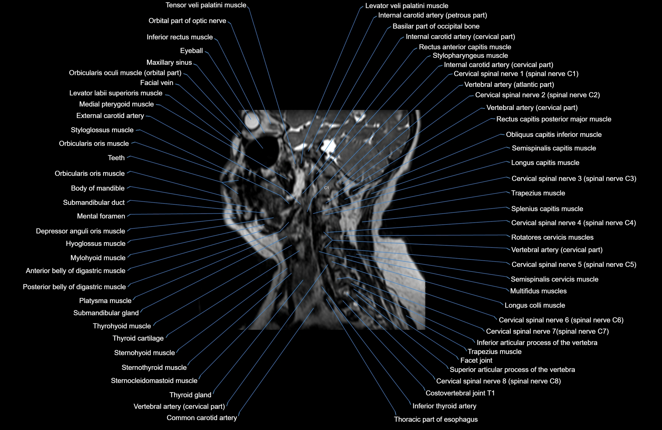Neck MRI sagittal cross sectional anatomy 3D 1mm 3T radiology  image-img-00001-00015.webp